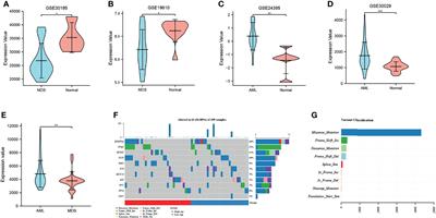 The Differential Expression of CD47 may be Related to the Pathogenesis From Myelodysplastic Syndromes to Acute Myeloid Leukemia